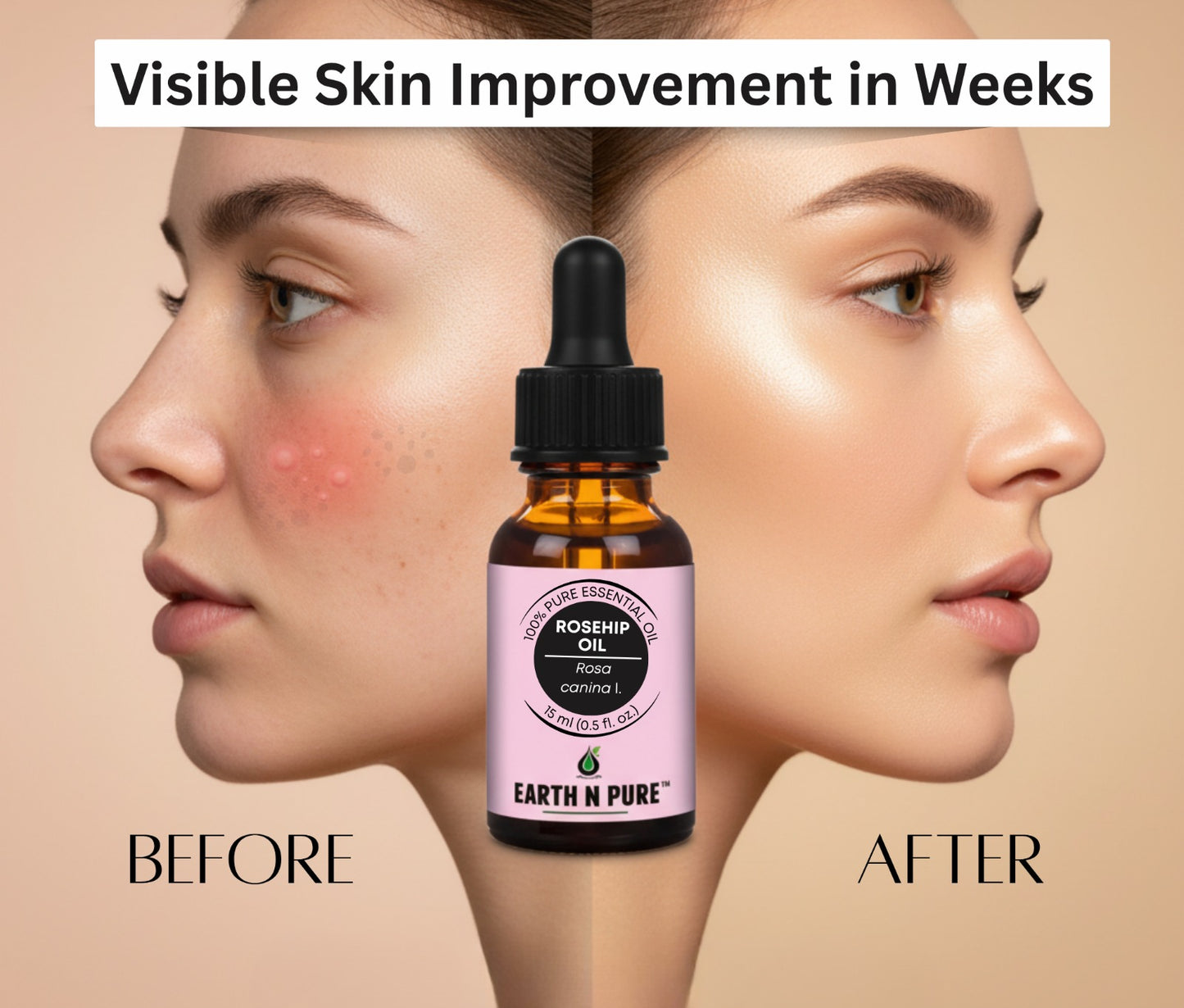 Earth N Pure Rosehip Oil for Face | Pure & Natural Skincare Oil